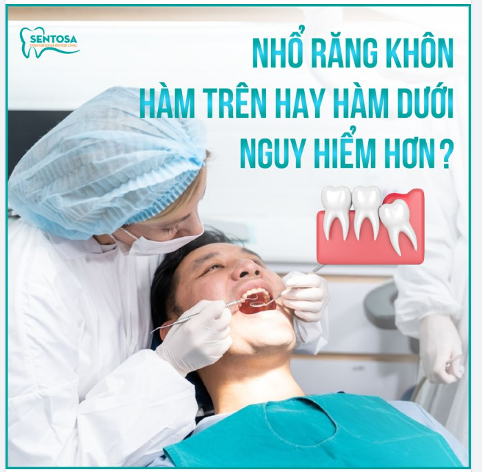 NHỔ RĂNG KHÔN HÀM TRÊN HAY HAM DƯỚI NGUY HIỂM HƠN