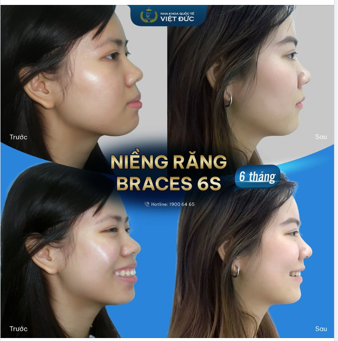 NHỮNG CÁCH ĐỂ CÓ GÓC NGHIÊNG THẦN THÁNH