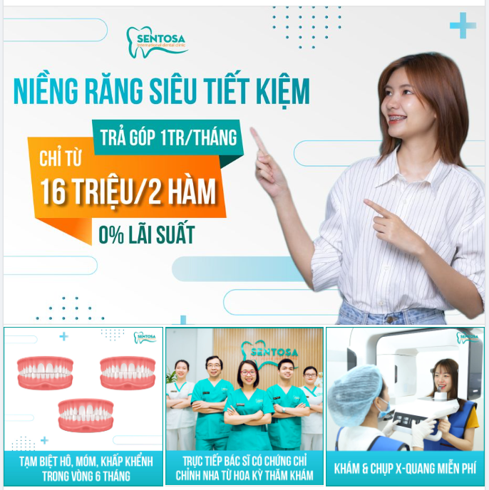 NIỀNG RĂNG CHỈ TỪ 1TRIỆU/1 THÁNG NGAY THÔI