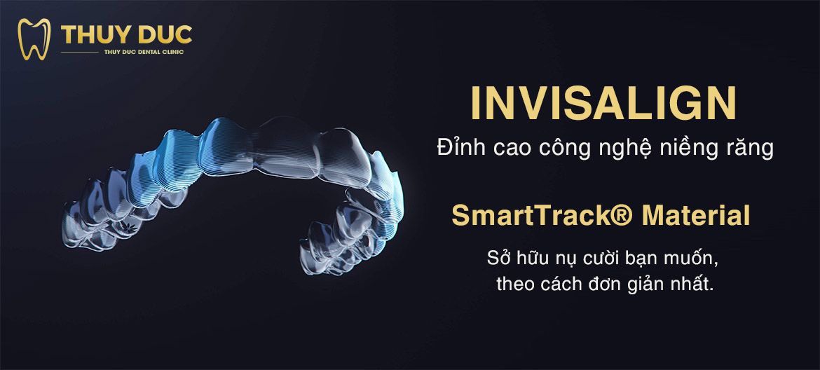 nieng-rang-invisalign-la-gi