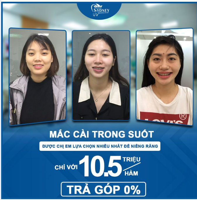 Niềng răng xong có đẹp hơn không  Những lợi ích thực tế từ niềng răng