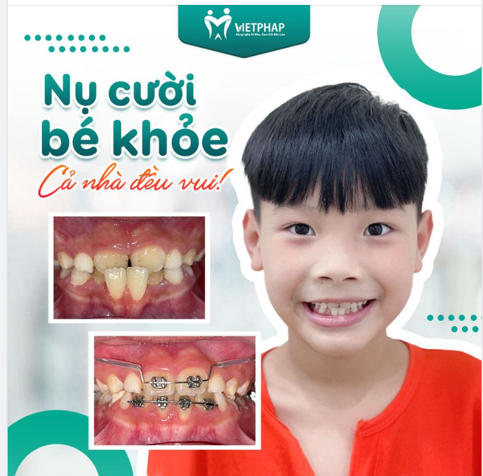 NỤ CƯỜI BÉ KHỎE – CẢ NHÀ THÊM VUI