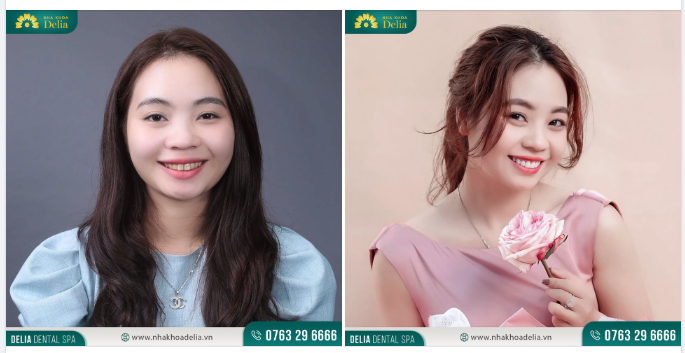 Nụ cười là liều thuốc giúp cho tinh thần của chúng ta luôn tích cực, cũng là sợi dây vô hình để kết nối những yêu thương.