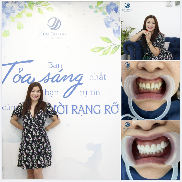 NỤ CƯỜI RẠNG RỠ - BỪNG TỎA NÉT RIÊNG