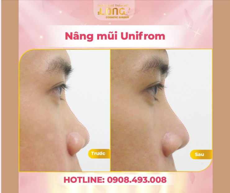 Ở nam giới, làm sao để tăng sự nam tính cho cánh mày râu mà không làm mất đi nét đẹp mạnh mẽ.