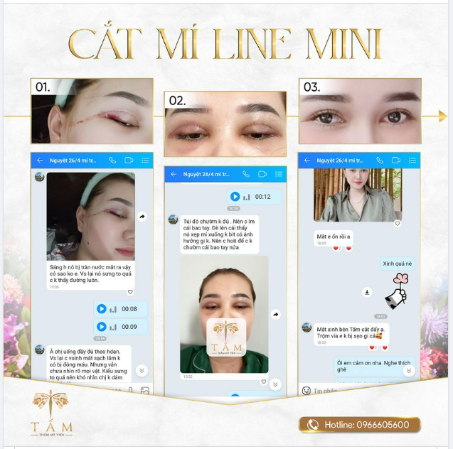 “ Ơ Thẩm Mỹ Viện Tấm lại bị phốt à ”