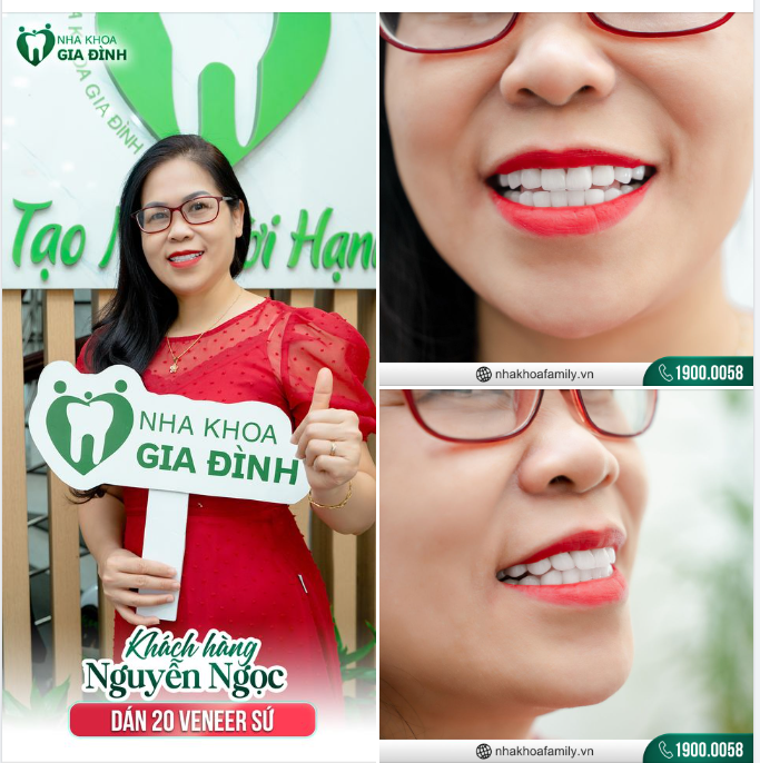 Răng đẹp không khó Chỉ cần có quyết tâm!