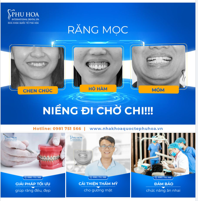 RĂNG MỌC CHEN CHÚC – HÔ – MÓM