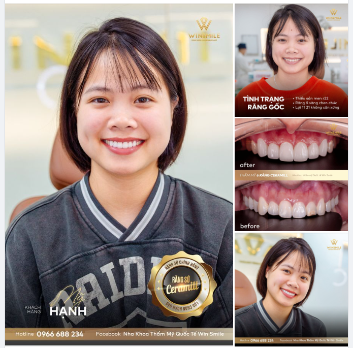 RẠNG RỠ NỤ CƯỜI TRÊN MÔI EM