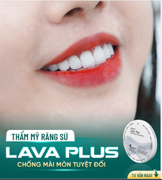 RĂNG SỨ LAVA PLUS - LỰA CHỌN HÀNG ĐẦU CỦA KHÁCH HÀNG THẨM MỸ RĂNG SỨ TẠI DELIA