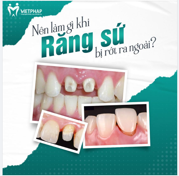 RĂNG SỨ MÀ RƠI MẸ BIẾT MẸ BUỒN ĐÓ