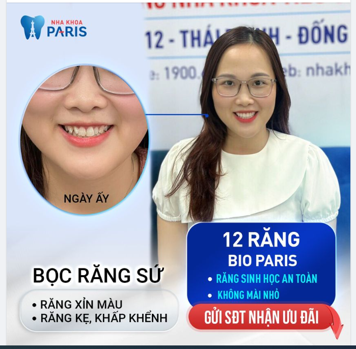 RĂNG SỨ  CHỌN GIÁ RẺ HAY GIÁ TRỊ NHẬN ĐƯỢC?