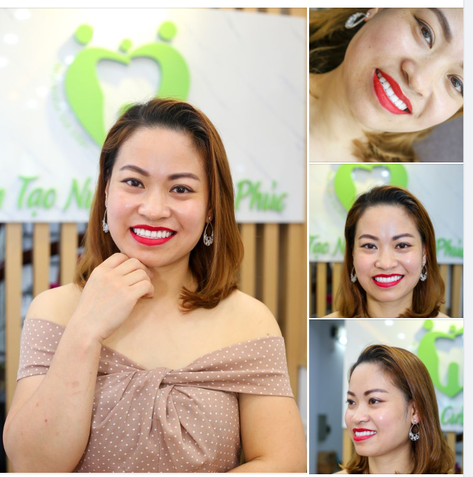RĂNG XINH CƯỜI ĐẸP - CHẲNG CÒN ÂU LO