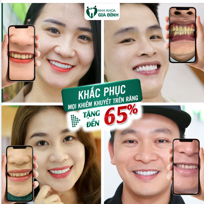 SỞ HỮU HÀM RĂNG ĐỀU ĐẸP, TRẮNG SÁNG KHÔNG GÌ LÀ KHÔNG THỂ!!!