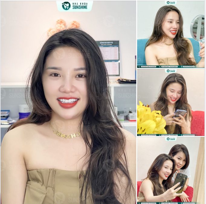 Tại sao Hoa khôi, Ca sĩ, Diễn viên, Mẫu ảnh,Hotgirl,… lựa chọn Sunshine để thiết kế lại nụ cười