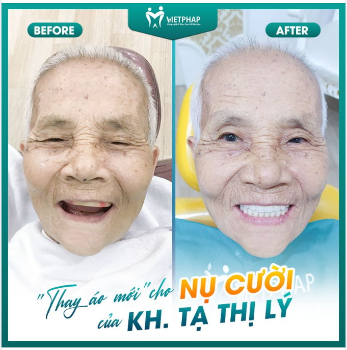 TẠI VIỆT PHÁP, “HỒI XUÂN” CHO NỤ CƯỜI CỦA KHÁCH HÀNG LÀ CÓ THẬT