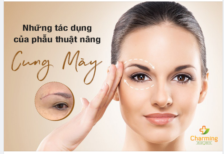TẤT TẦN TẬT VỀ TÁC DỤNG CỦA PHẪU THUẬT N NG CUNG MÀY