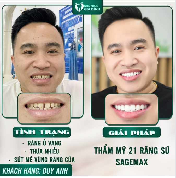 THẨM MỸ NỤ CƯỜI - LẤY LẠI PHONG ĐỘ PHÁI MẠNH