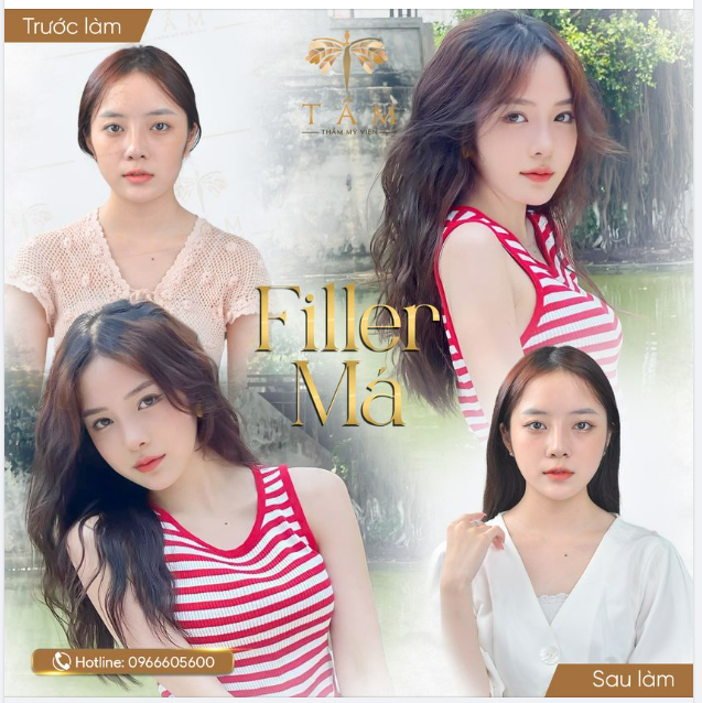 Thẩm mỹ “sương sương” kết quả hoàn hảo không tưởng.