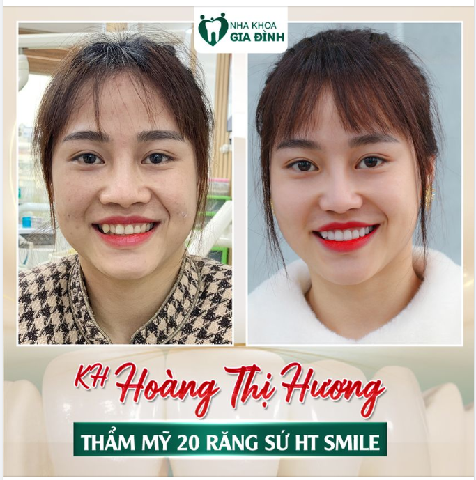 THANH XUÂN CỦA CÔ ẤY NẰM TRỌN TRONG NỤ CƯỜI