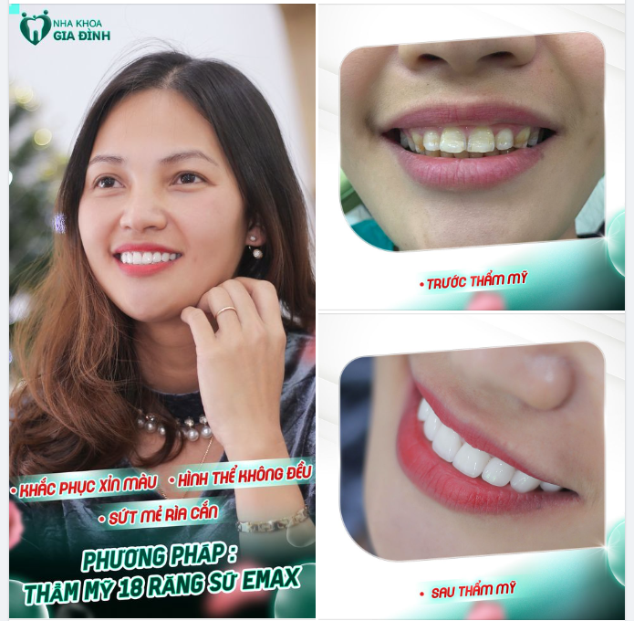 THAY ĐỔI NHAN SẮC CHỈ SAU 2 NGÀY