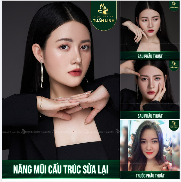 THU HÚT MỌI ÁNH NHÌN VỚI CHIẾC MŨI CAO XINH CHUẨN HOTGIRL!!!