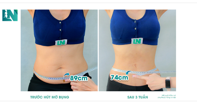 TRỞ VỀ ĐÚNG DÁNG VÓC ƯỚC MONG