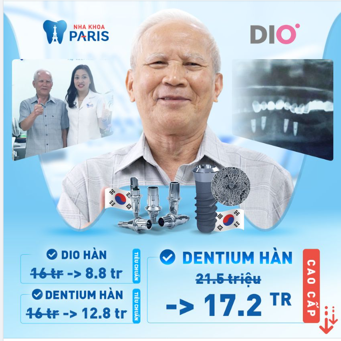 TRỒNG RĂNG HÀN QUỐC - GIÁ NÀO HỢP?