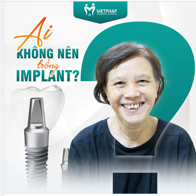 TRƯỚC KHI QUYẾT ĐỊNH TRỒNG RĂNG IMPLANT, ĐỪNG BỎ QUA ĐIỀU NÀY…