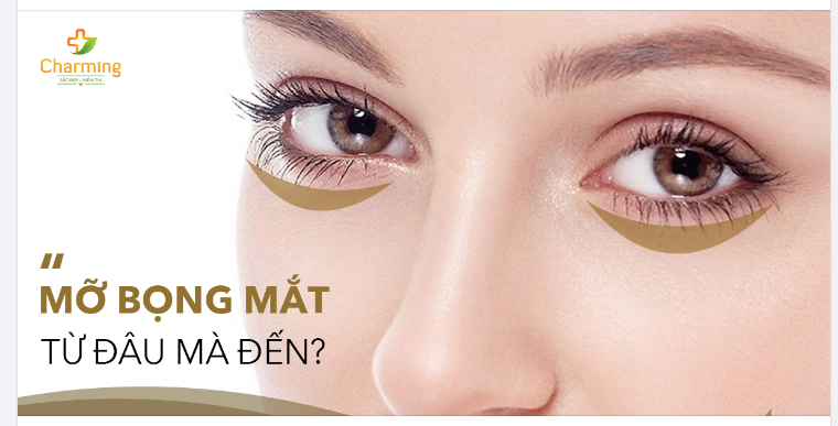 VÌ SAO ĐƯA MỠ BỌNG MÍ ĐẾN