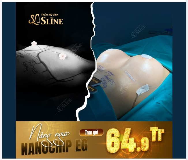Với 64,9tr bạn sẽ được những gì