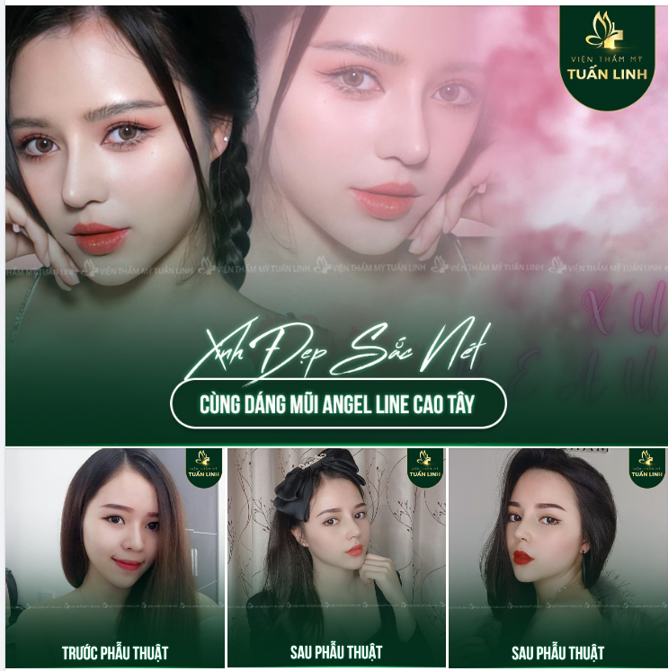 XINH ĐẸP SẮC NÉT CÙNG DÁNG MŨI ANGEL LINE CAO TÂY 