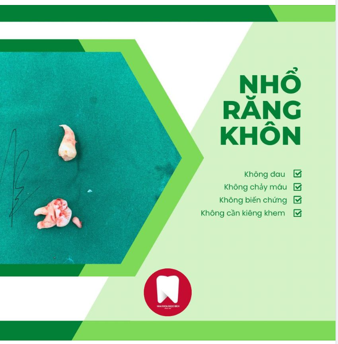 XOÁ TAN NỖI SỢ NHỔ RĂNG KHÔN