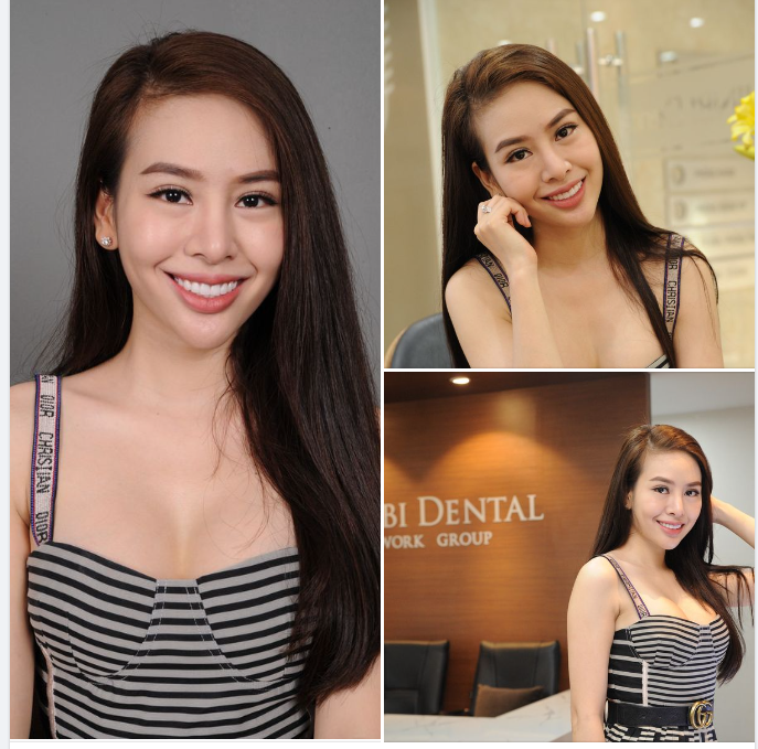 CÔ GÁI VỚI KHUÔN MẶT CƯỜI RẠNG RỠ, LÀN DA CĂNG TRÀN SỨC SỐNG – PHẠM QUỲNH ANH