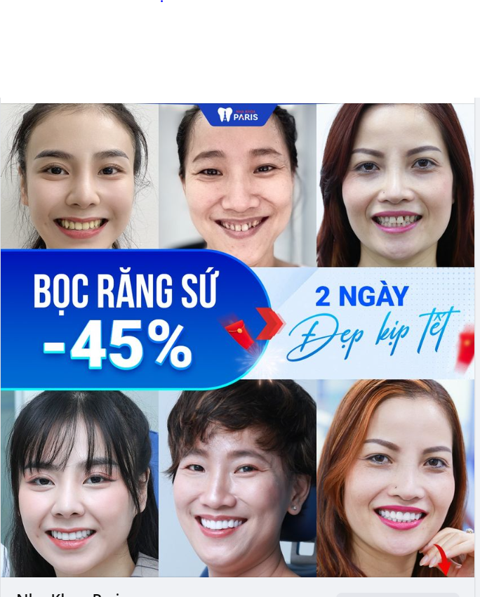 “TUYỆT CHIÊU” CHE PHỦ RĂNG NHIỄM MÀU SAU 48H, KHÔNG MÀI NHỎ RĂNG