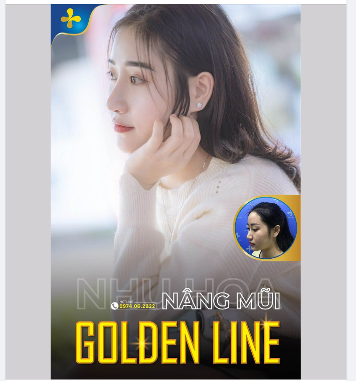 Đã có rất nhiều chị em chọn cho mình phương pháp tiêm filler để cải thiện dáng mũi của mình, nhưng không phải ai cũng may mắn đạt được kết quả như ý.