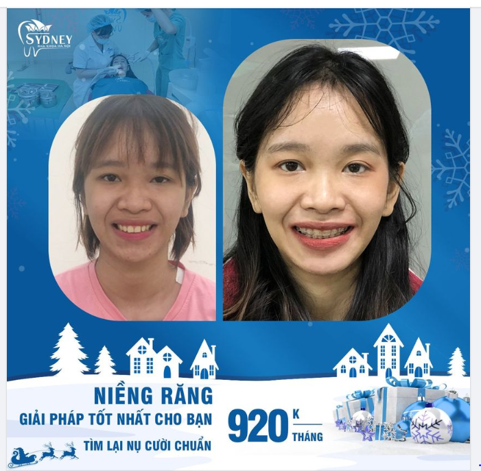 Mùa noel – Đón Giáng sinh – Rung rinh nhận ưu đãi