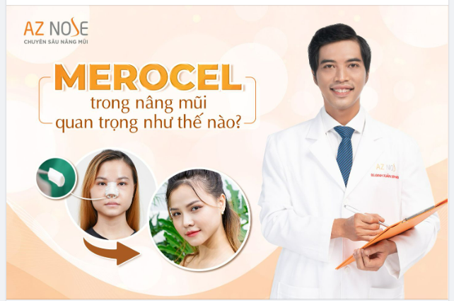 3 LỢI ÍCH CỦA MEROCEL TRONG NÂNG MŨI