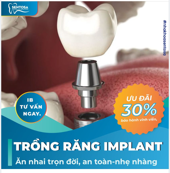 TRỒNG RĂNG IMPLANT - THAY THẾ RĂNG MẤT HOÀN HẢO