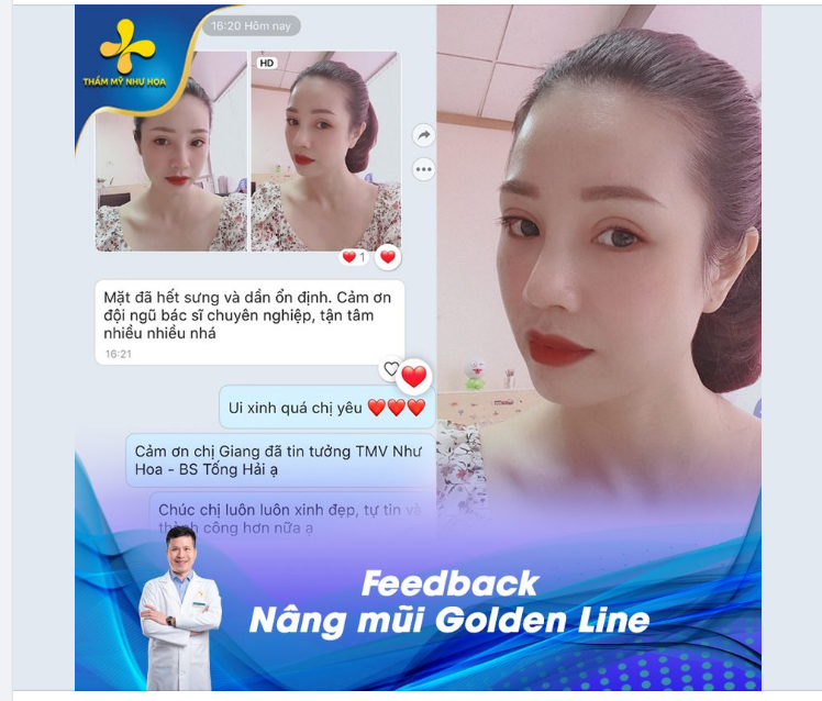 NÂNG MŨI KHÔNG CHỈ ĐỂ XINH, NÂNG MŨI LÀ ĐỂ CHỤP ẢNH KHÔNG KIÊNG GÓC NÀO