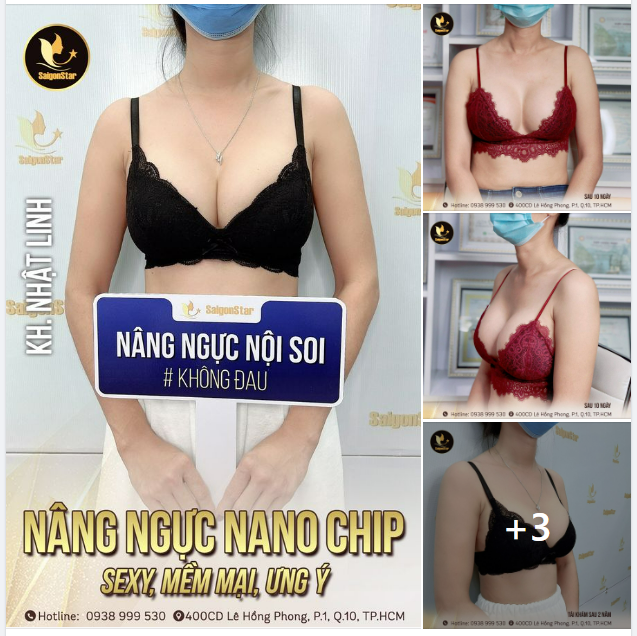 NÂNG NGỰC NANO CHIP SEXY, MỀM MẠI, ƯNG Ý