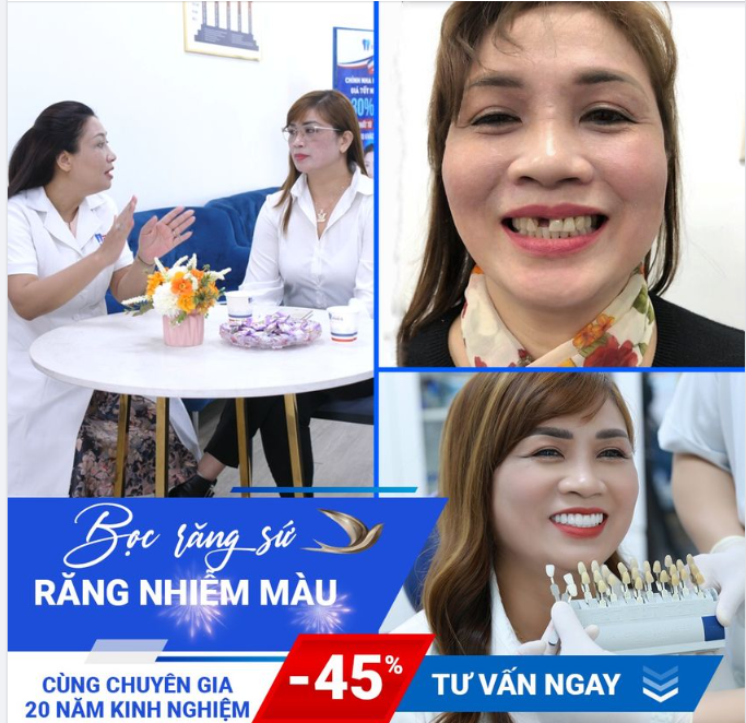 BỌC SỨ 2 BUỔI KỊP TẾT| TRỢ GIÁ 50,4 TR