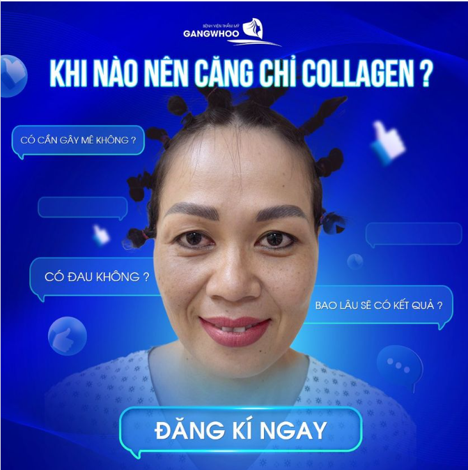 KHI NÀO NÊN CĂNG DA MẶT BẰNG CHỈ COLLAGEN