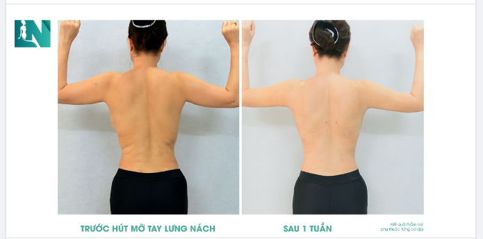 LƯNG THON NUỘT NÀ ĐƯỜNG CONG NỮ TÍNH!