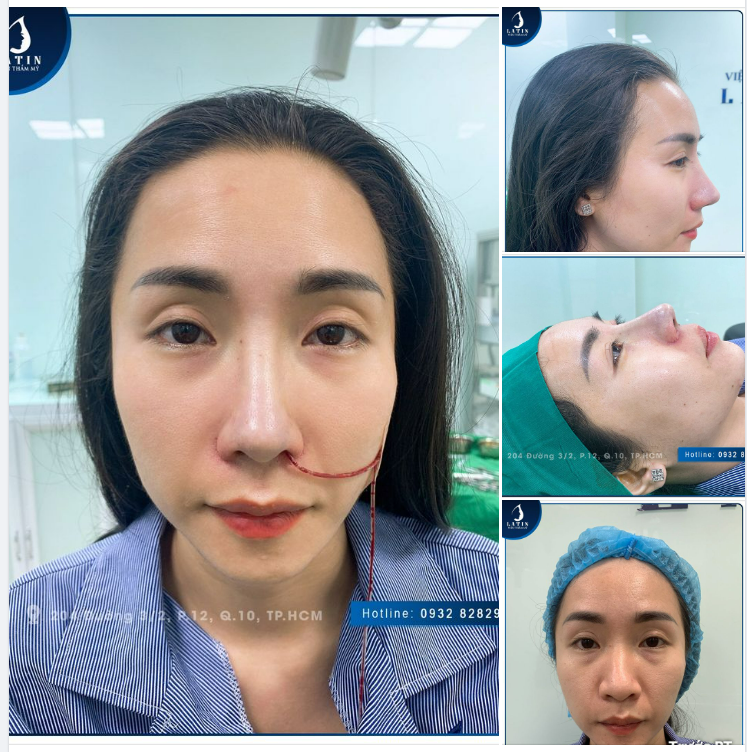 KHOE SIÊU PHẨM MŨI BÁN CẤU TRÚC NHÀ LATIN