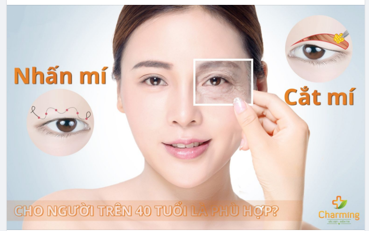 TUỔI 40 NÊN CẮT HAY NHẤN MÍ ĐỂ TẠO MẮT HAI MÍ?