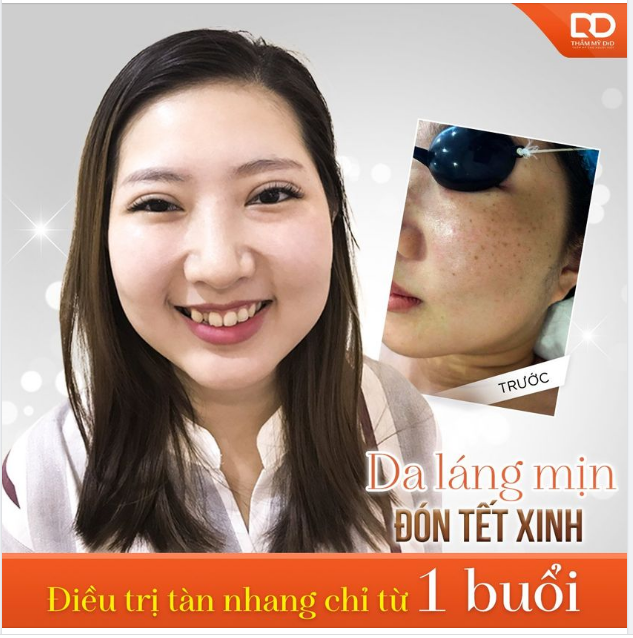 Không dám để mặt mộc vì da quá nhiều tàn nhang, dùng đủ mọi cách mà da vẫn thế.