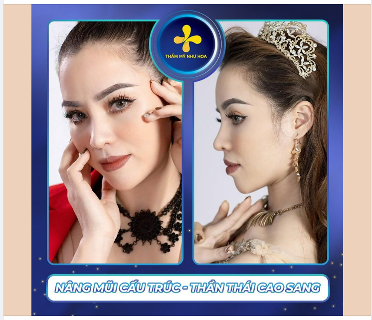 Một chiếc mũi hoàn hảo sẽ mang lại cho bạn những gì?