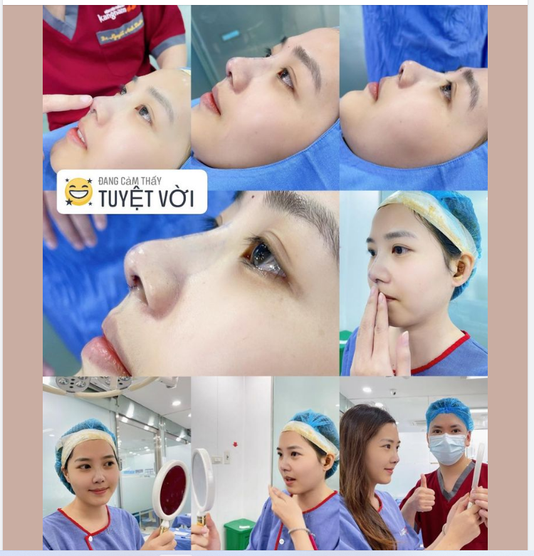 Ảnh chất lượng thấp nhưng Mũi chất lượng cao