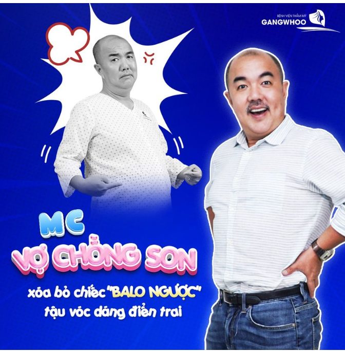 MC VỢ CHỒNG SON XÓA BỎ CHIẾC "BALO NGƯỢC" TẬU VÓC DÁNG ĐIỂN TRAI